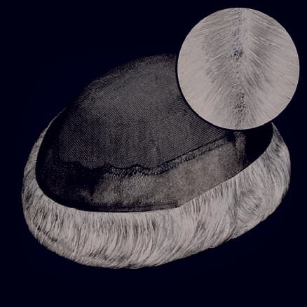 NCT - Mono top lace system